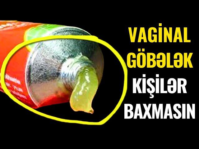 KİŞİLƏR BAXMASIN! - Göbələyin Doğru Müalicəsi belə aparılır