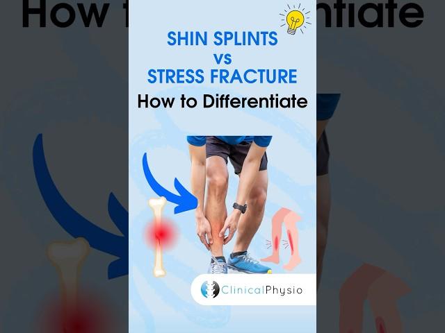 Shin Splints vs. Stress Fracture #physicaltherapy #physiotheraphy #shinsplints