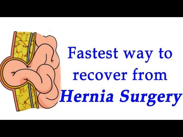 Fastest way to recover from hernia surgery- Dr. Nanda Rajaneesh