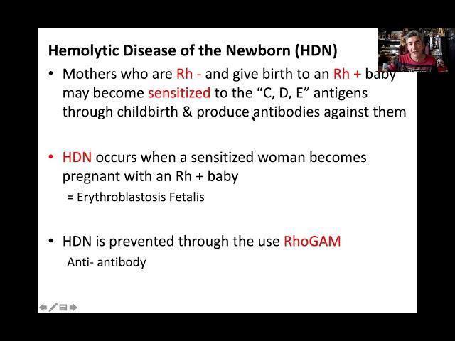 Hemolytic Disease of the Newborn HDN