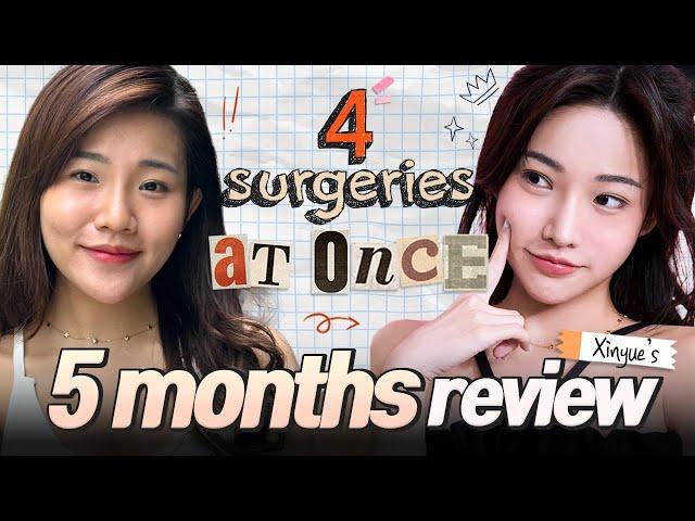 Having 4 surgeries at ONCE!  | Xinyue's PLASTIC SURGERY journey at BRAUN (Part 2)