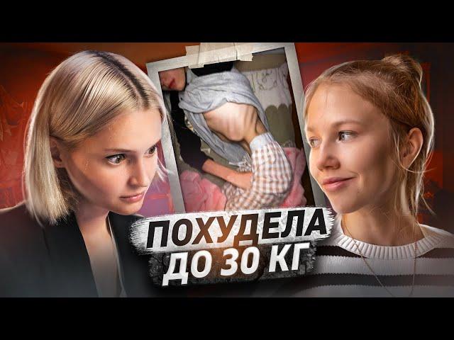 РПП: анорексия и булимия | ВЕСИЛА 30 кг