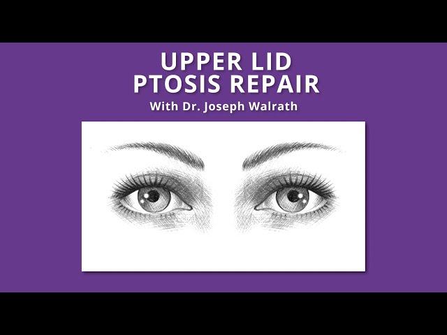 Upper Lid Ptosis Repair