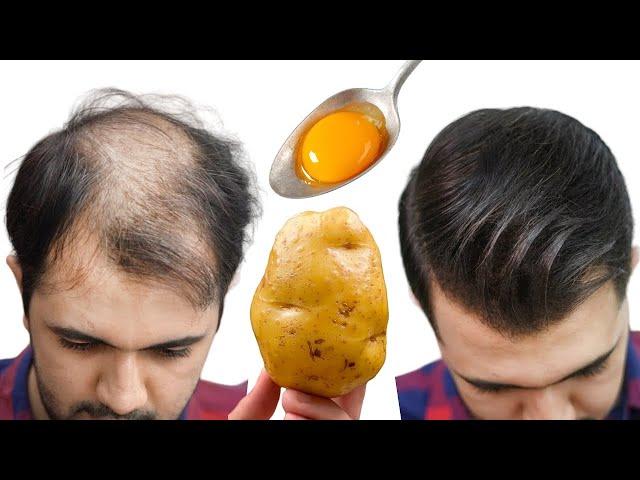 Hair grows like crazy and doesn't fall out! This is the most powerful tool! Strongest ingredient