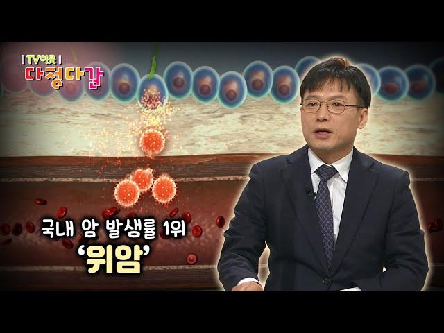 ‘의학 알지’ 위암 / KBS대전 20210415 방송