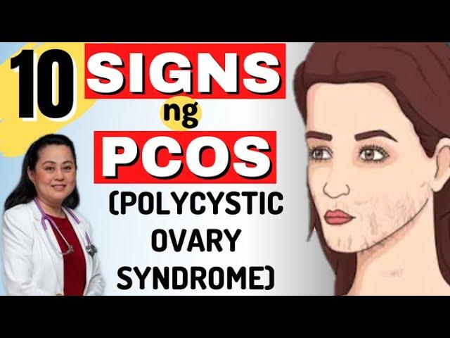 10 Signs ng PCOS (Polycystic Ovary Syndrome) - By Doc Liza Ramoso-Ong #1484