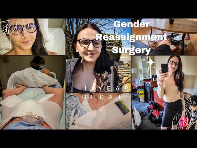 Gender Reassignment Surgery 1 year Anniversary