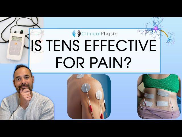 Does TENS Actually Work? | Expert Physio Review