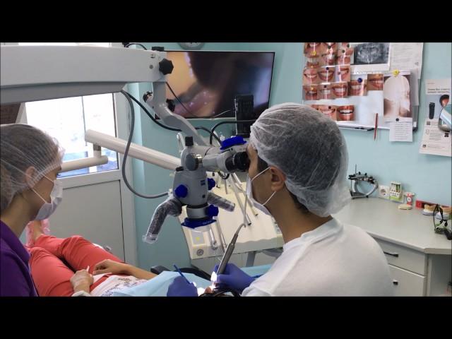 Сolor composite in the preparation, for good visualization. tooth preparation