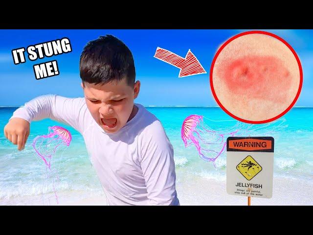 HE got Stung at the BEACH by JELLYFISH!!
