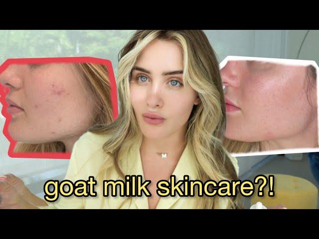 HOW I FINALLY CLEARED MY SKIN! (Goat's milk??)