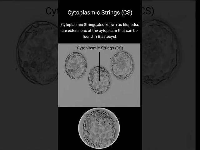 Cytoplasmic Strings (Cyt-S) in Blastocyst Embryo#blastocyst