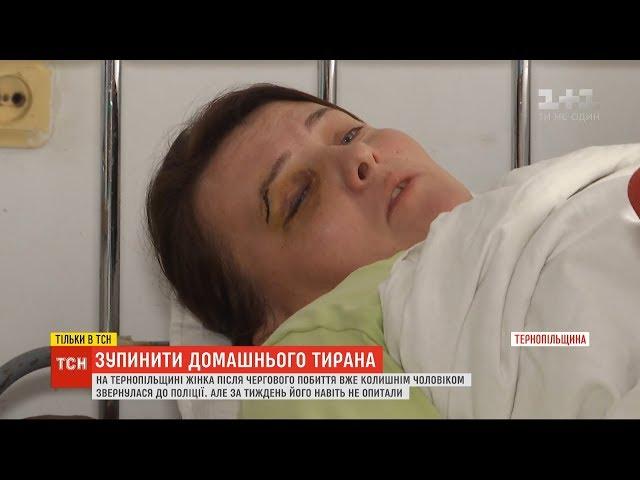 Поліція на Тернопільщині ігнорує регулярні побиття жінки її колишнім чоловіком