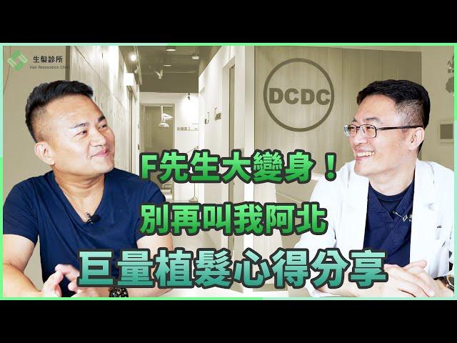 F先生大變身！別再叫我阿北｜巨量植髮心得分享｜DCDC精準植髮