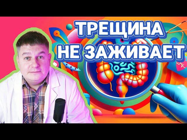 Откровенная правда: почему ваша анальная трещина не заживает? Проктолог открывает тайны!