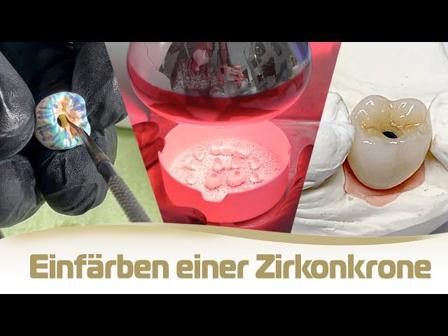 Herstellung Zirkonkrone: Bemalen und Sintern einer monolithischen Zahnkrone