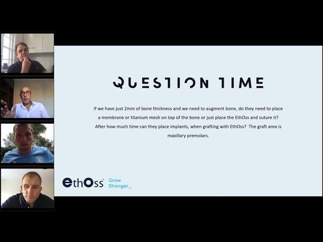 EthOss: QuestionTime
