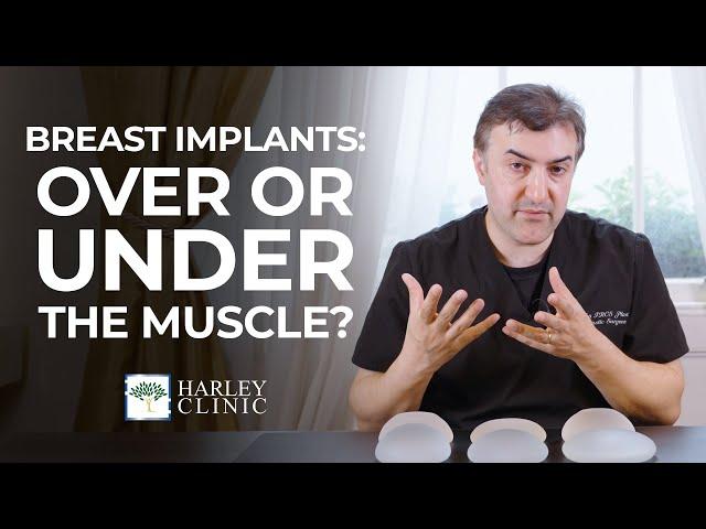 Breast Implants: Should They Go Over Or Under The Muscle? | Harley Clinic Group