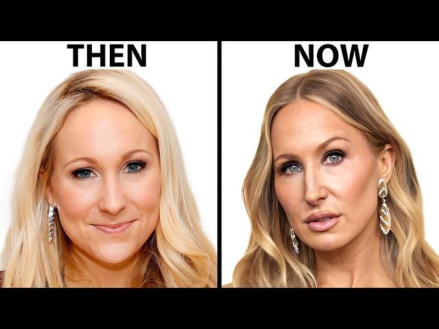 Nikki Glaser's NEW FACE | Plastic Surgery Analysis