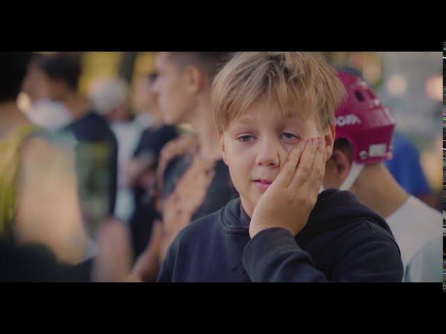 КОНТЕСТ BMX ЧЕРНИГОВ | BMX Contest (teaser 2)