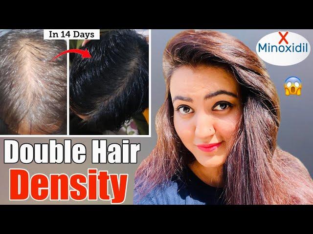 14 Days Challenge : Try This Hair Growth Remedy To Get Double Hair Density & Thick, Long Hair️