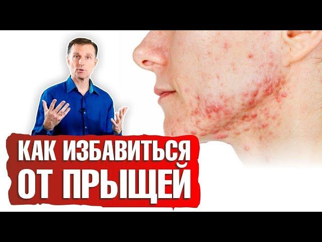 Как избавиться от прыщей?