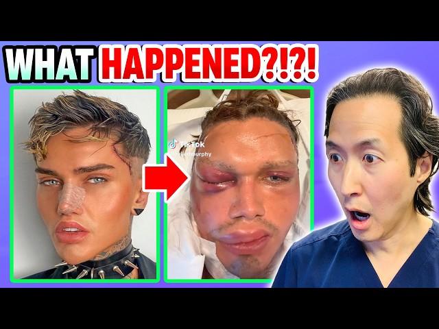 Plastic Surgeon Reacts to 5 Surgeries/1 Day Going HORRIBLY Wrong!