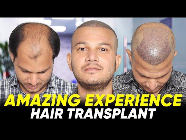 Hair Transplant in Indore | Best Results & Cost of Hair Transplant in Indore