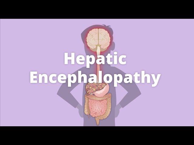 Cirrhosis – Hepatic encephalopathy