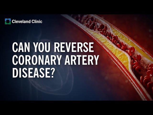 Can You Reverse Coronary Artery Disease?