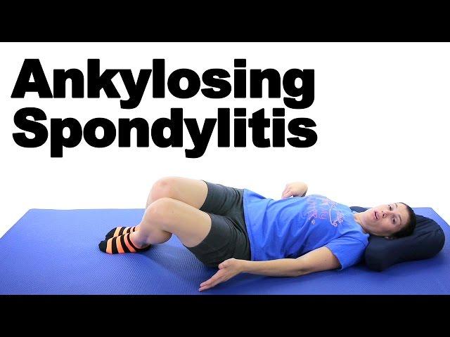 Ankylosing Spondylitis Stretches & Exercises - Ask Doctor Jo