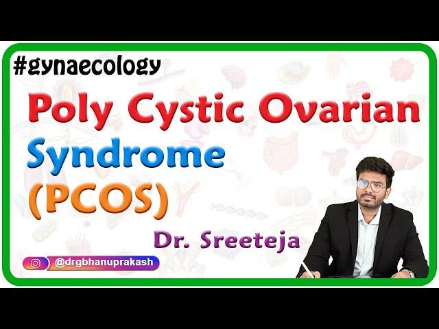 Poly Cystic Ovarian Syndrome (PCOS) / Stein–Leventhal syndrome / Hyperandrogenic anovulation