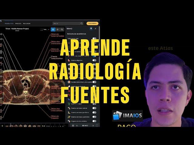 Título: Fuentes Esenciales para Aprender Radiología: Guía Completa.