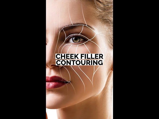 Enhancing Facial Harmony: Journey into Cheek Fillers