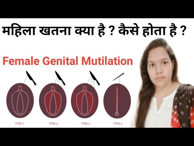 माहिला खतना क्या है? और कैसे होता है? | What is Female Genital Mutilation ? @Narijivan