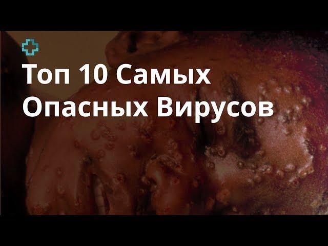 Топ 10 Самых Опасных Вирусов