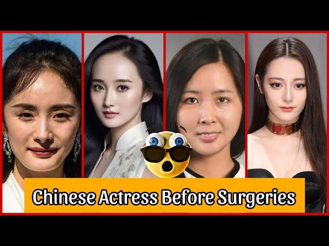 Chinese Actress Before And After Plastic Surgeries  Incredible Changes  2024