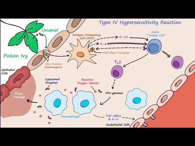 Type IV Hypersensitivity (Described Concisely)