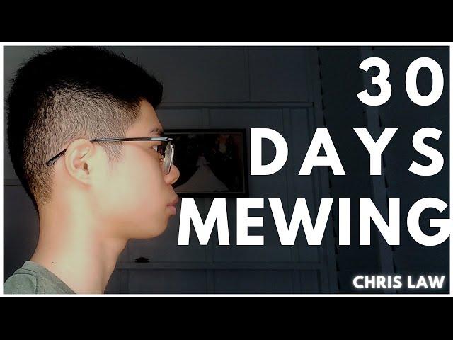 30 Days Mewing Result (First Month)