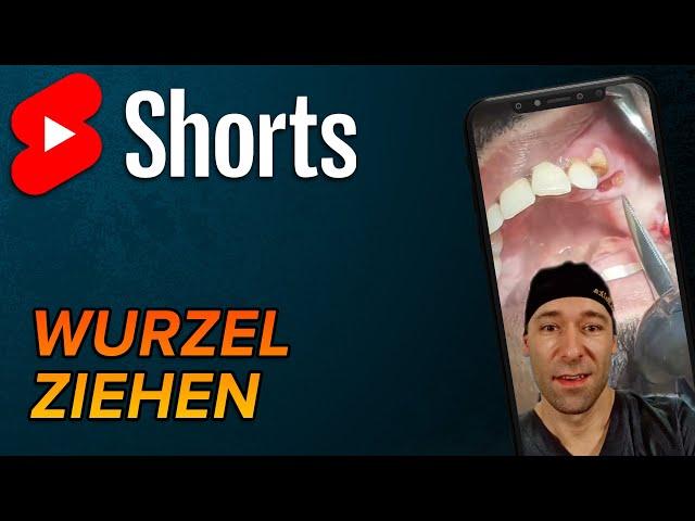 Wurzelrest ziehen #shorts