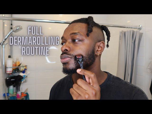 MY MINOXIDIL BEARD JOURNEY WEEK 40 | MY FULL DERMAROLLING ROUTINE