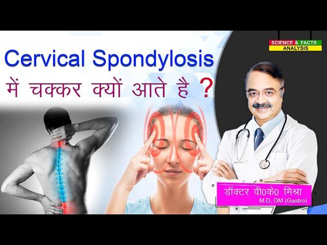 Cervical Spondylosis में चक्कर क्यों आते है ? || Why is there dizziness in Cervical Spondylosis?