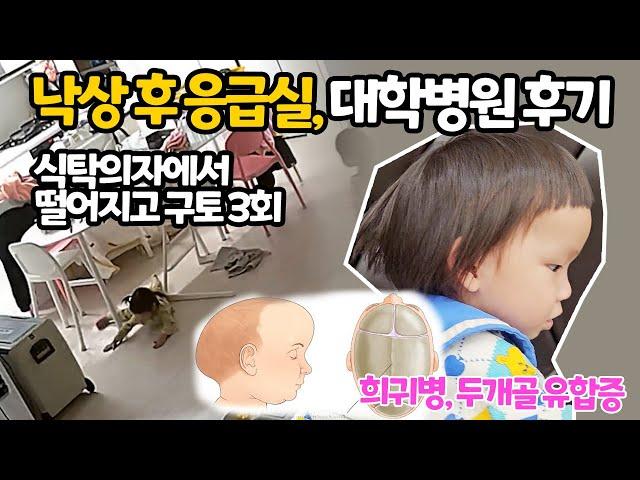 26개월 루다, 낙상 후 응급실 다녀왔는데 희귀병 진단 받고 온 병원 후기 | 두개골유합증