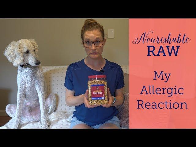 Why I Spent Yesterday Afternoon in the Emergency Room | Nourishable Raw Episode 21