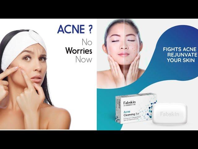 Fabskin acne soap unboxing #onlinebuyer #mediconlinebuyer #antiacnesoap #clinsolsoap #onlinebuyergym