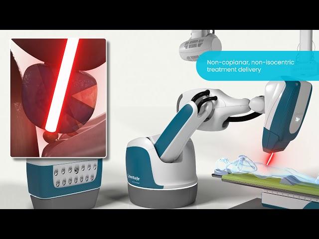 Treating Prostate Tumors with Precision Radiation on the #CyberKnife S7 System