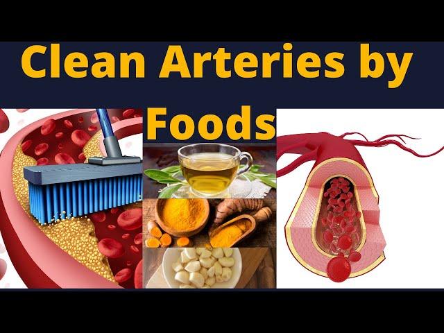 Foods that clean your arteries naturally | super foods to clean your arteries | unclog arteries |