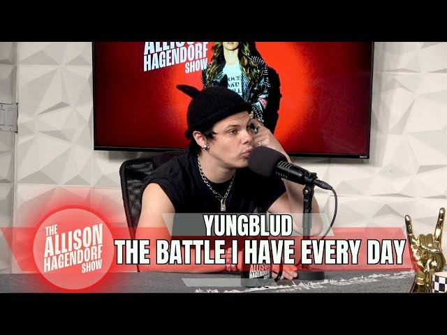 YUNGBLUD - The Battle I Have Every Day - The Allison Hagendorf Show