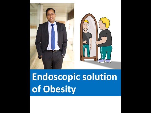 Motape ka ilaj (मोटापे का इलाज ). Endoscopy for weight loss and obesity, Endoscopy se wazan kam.