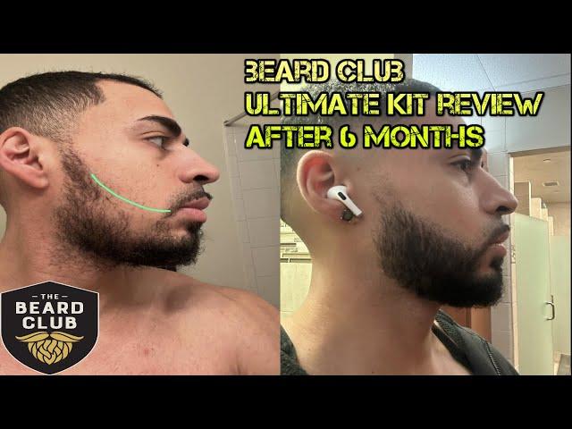 Beard Club Growth Kit Review, Before and After Results (6 Month UPDATE), Does Beard Club Work?